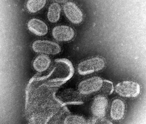 грипп и орви в микроскоп